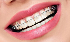 Ортодонтия