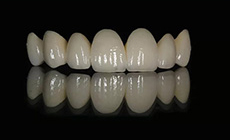 Протезирование